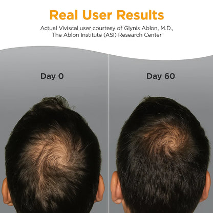 Men's Hair Growth Supplements